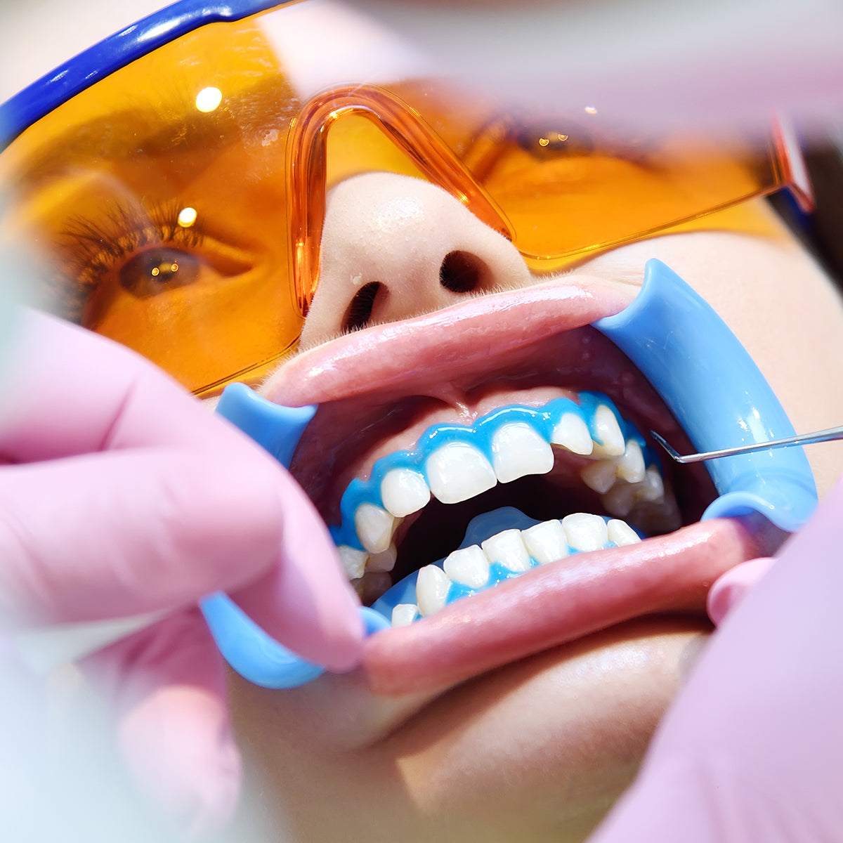 DENTAL ACCESSORIES