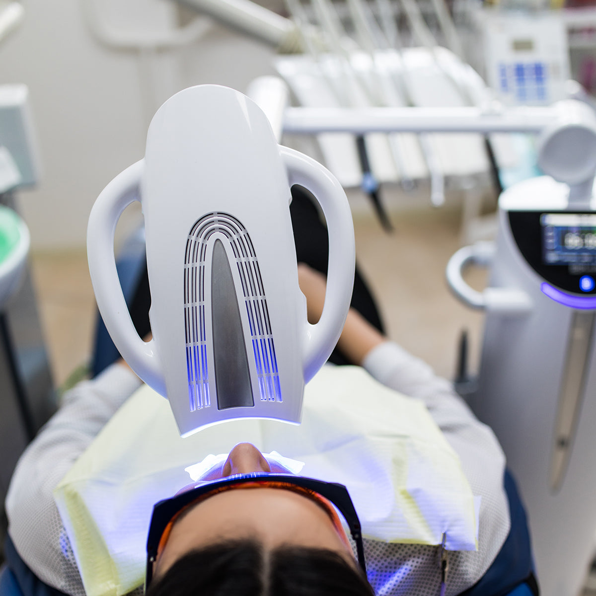 IN-OFFICE WHITENING